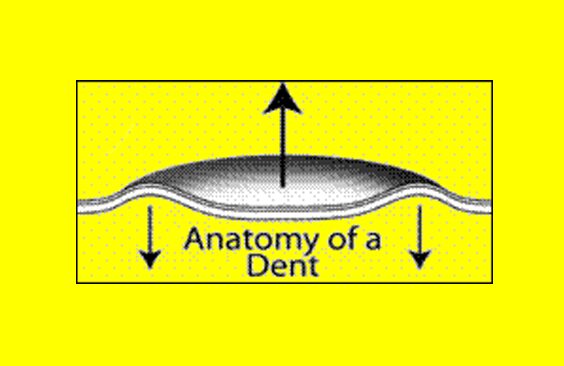 anatomy of a dent