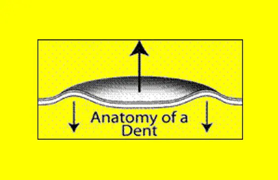 anatomy of a dent